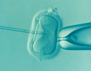 Preimplantační genetická diagnostika – zjištění nemoci u embrya po umělém oplodnění, před přenosem do děloh matky 