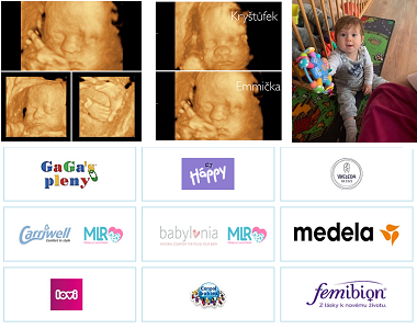 Katka v 29. týdnu těhotenství byla na 3D ultrazvuku