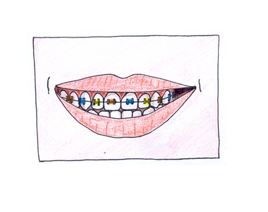 Ortodontické vady a jejich náprava