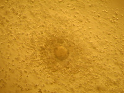 Vajíčko po odběru na IVF