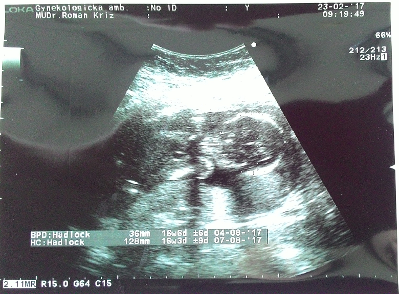 Kontrola u gynekologa Kontrola u gynekologa