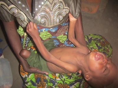 Malawi1