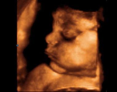 26.-29. týden vývoje miminka