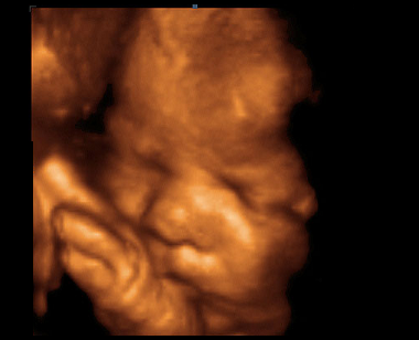 33. týden těhotenství