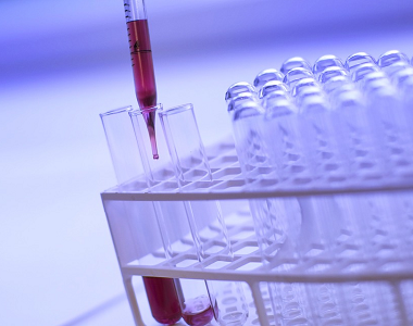 Chlamydiová infekce