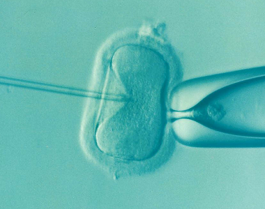 Preimplantační genetická diagnostika – zjištění nemoci u embrya po umělém oplodnění, před přenosem do děloh matky