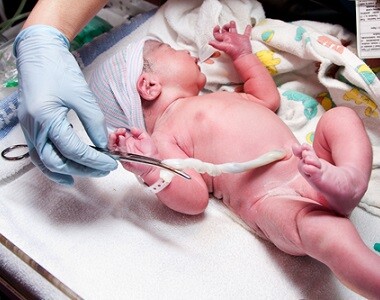 Pupečník a vznik pravého uzlu na něm