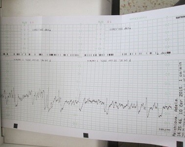 Terezka je na světě!