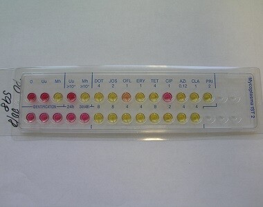 Ureaplazmata a mykoplazmata