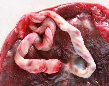 Placenta, její funkce a pojídání placenty