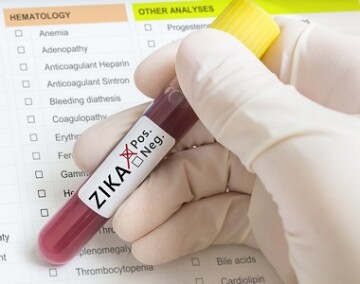 Virus ZIKA jako původce mikrocefalie plodu
