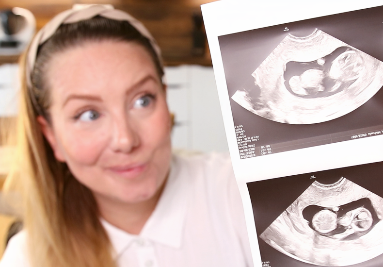 https://www.babyonline.cz/files/media/1lpbthnrcnznapafwrzbrvoettplweu9.png