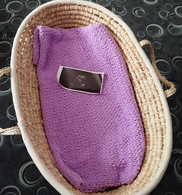https://www.babyonline.cz/files/media/gup6lk0j5fkwkilbiqi38cslhgxyoux7.jpg