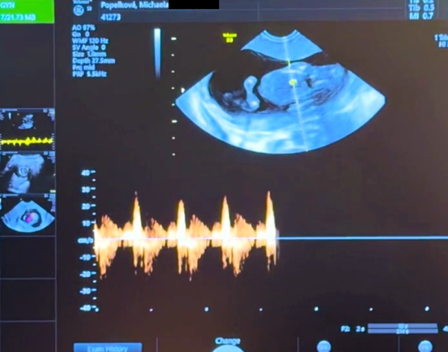 https://www.babyonline.cz/files/media/lilzl8szs8gvmgljzdlfxmlxdhcqco3y.png