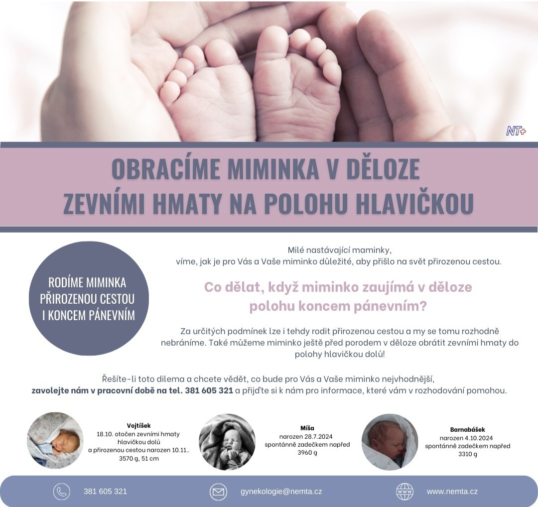 https://www.babyonline.cz/files/media/qwbjhlqcwzsnn8ogd5i5f4rls8fmlqqr.jpg