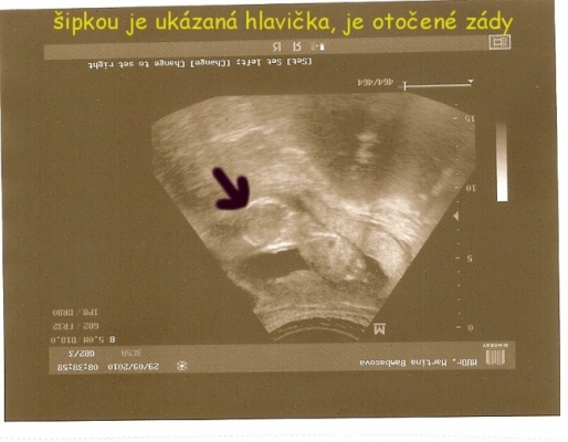 120121