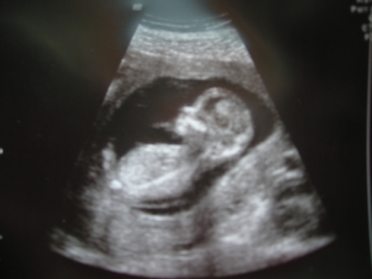 2009
