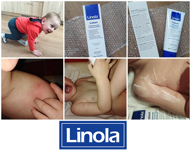Edita testuje tělové mléko Linola Lotion