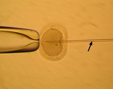 Fota z IVF