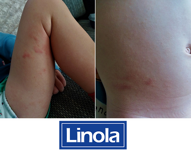 Lenka testuje tělové mléko Linola Lotion