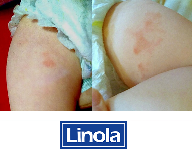 Markéta testuje tělové mléko Linola Lotion