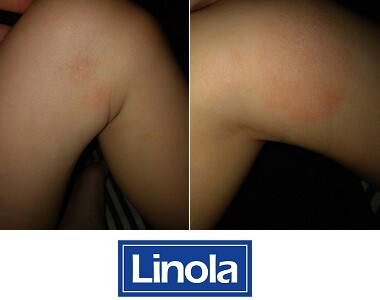 Renata testuje tělové mléko Linola Lotion