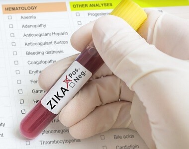 Virus ZIKA jako původce mikrocefalie plodu