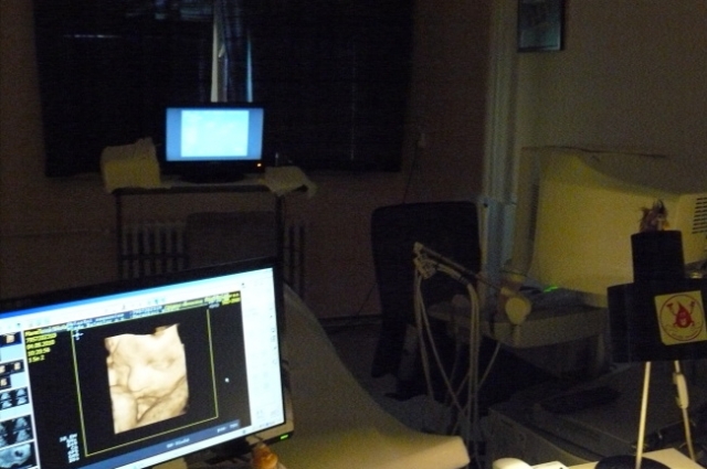 Oblastní nemocnice, a.s. - Klaudiánova nemocniceAmbulanceNa gynekologicko-porodnickém oddělení mají maminky možnost vyšetření 3D ultrazvukem – zde s ukázkou miminka v přítmí ambulance